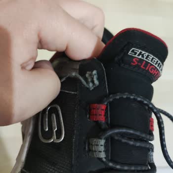 Bağcıksız Çocuk Ayakkabısında Beklenmedik Kopma Ve Garanti Sorunuyla Karşılaştım