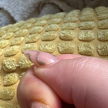 Protez Tırnaklar Kısa Sürede Bozuldu, İlgisiz Ve Çözüm Sunmayan Yaklaşım