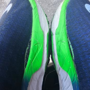 Ayakkabıda Açılma Sorunu Ve Fatura Talebimin Reddedilmesi