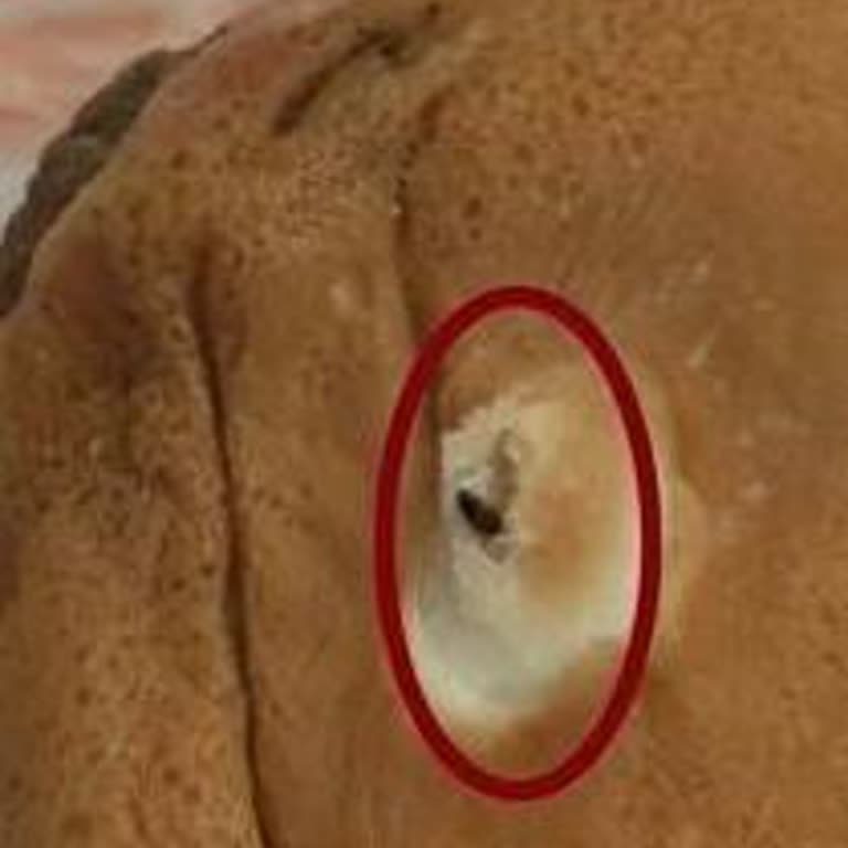 Hamburgerimden Böcek Çıktı, İlgisizlikle Karşılaştım!