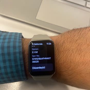 Xiaomi Mi Band Pro 9 Cihazımda Tekrarlayan Sorunlar Ve Yetersiz Müşteri Hizmeti