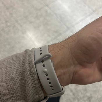 Xiaomi Mi Band Pro 9 Cihazımda Tekrarlayan Sorunlar Ve Yetersiz Müşteri Hizmeti