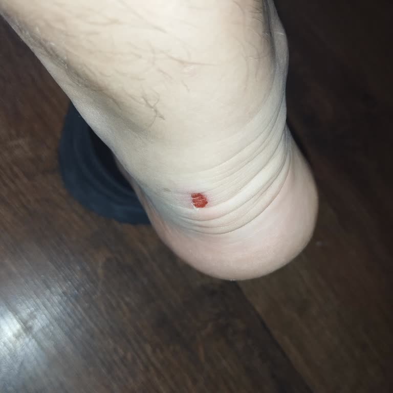 İlk Giyişte Yara Yapan Ayakkabı İçin İade Talebim Reddedildi