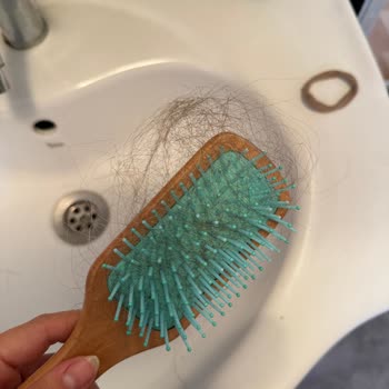 Otacı Şampuan Kullanımı Sonrası Yoğun Saç Dökülmesi Ve Ücret İade Talebi