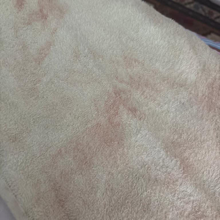 Yeni Alınan Kanepede Silme Sonrası Yoğun Renk Kaybı Ve Servis İlgisizliği