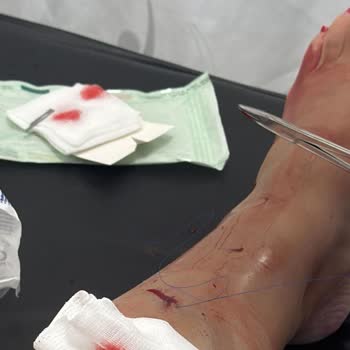 Otelin İhmali Sonucu Yaşanan Yaralanma Ve İlgisizlik