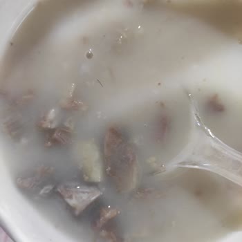 Siparişimden Defalarca Kıl Çıkması Ve İlgisizlik