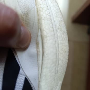 Üç Ayda Açılan Ayakkabı Ve Reddedilen Değişim Talebi