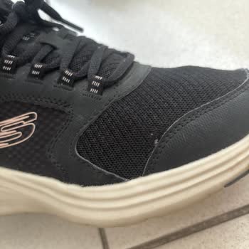Kısa Sürede Yırtılan Skechers Ayakkabıya Garanti Reddi Mağduriyeti