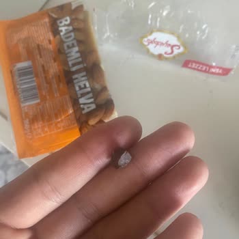 Helva İçinden Taş Çıkması Nedeniyle Sağlık Riski Ve Hayal Kırıklığı