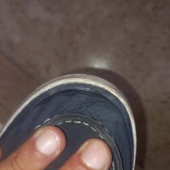 Aldığım Easy Street Ayakkabılar Kısa Sürede Yıprandı, Tadilat Sonrası Sorunlar Devam Ediyor