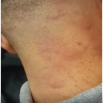 Otobüste Tahta Kurusu Ve Hijyen Sorunu Nedeniyle Sağlık Problemi Yaşadım