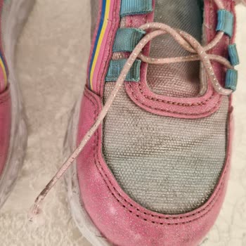 Kız Çocuk Ayakkabısı 5 Günde Deforme Oldu, Mağaza İlgisiz Kaldı