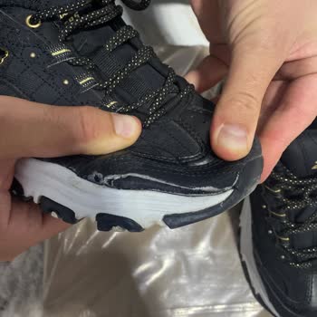 Skechers Garanti Sürecinde Yetersiz Destek Ve Ürün Sorununa Çözüm Sunulmaması