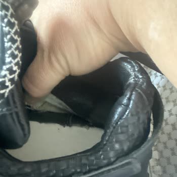 Tergan Ayakkabıda Kısa Sürede Oluşan Yırtık Ve Red Edilen İnceleme Sonucu