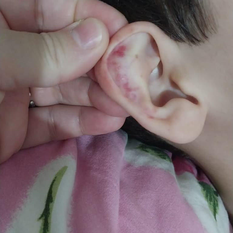 Çocuk Acil Bölümünde İlgisizlik Ve Yetersiz Tedaviyle Yaşanan Mağduriyet