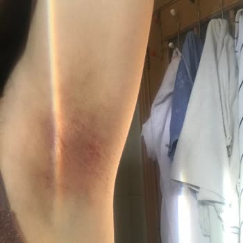 Yves Rocher Roll On Ürünü Cildimde Alerjiye Sebep Oldu, Ücret İadesi Talep Ediyorum