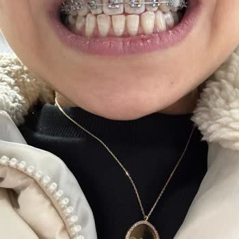 DT. Filiz Şafak Diş Teli Tedavisinde Yaşatılan Mağduriyet!