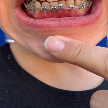 DT. Filiz Şafak Diş Teli Tedavisinde Yaşatılan Mağduriyet!