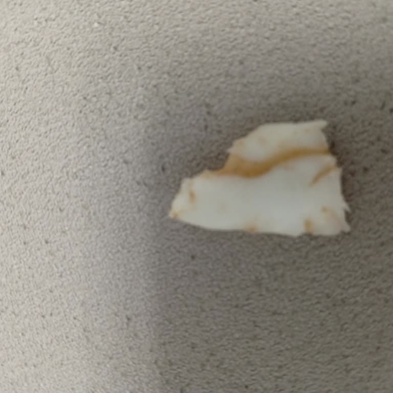 Nuga Bar Çikolatanın İçinden Büyük Ve Sert Yabancı Cisim Çıktı: Sağlık Riski!