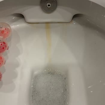 İki Aylık Yeni Klozetlerin Hızla Sararması Hayal Kırıklığı Yarattı