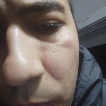 Deva İlaç Amoklavin Kullanımı Sonrası Yaşanan Kalp Ritim Bozukluğu Endişesi