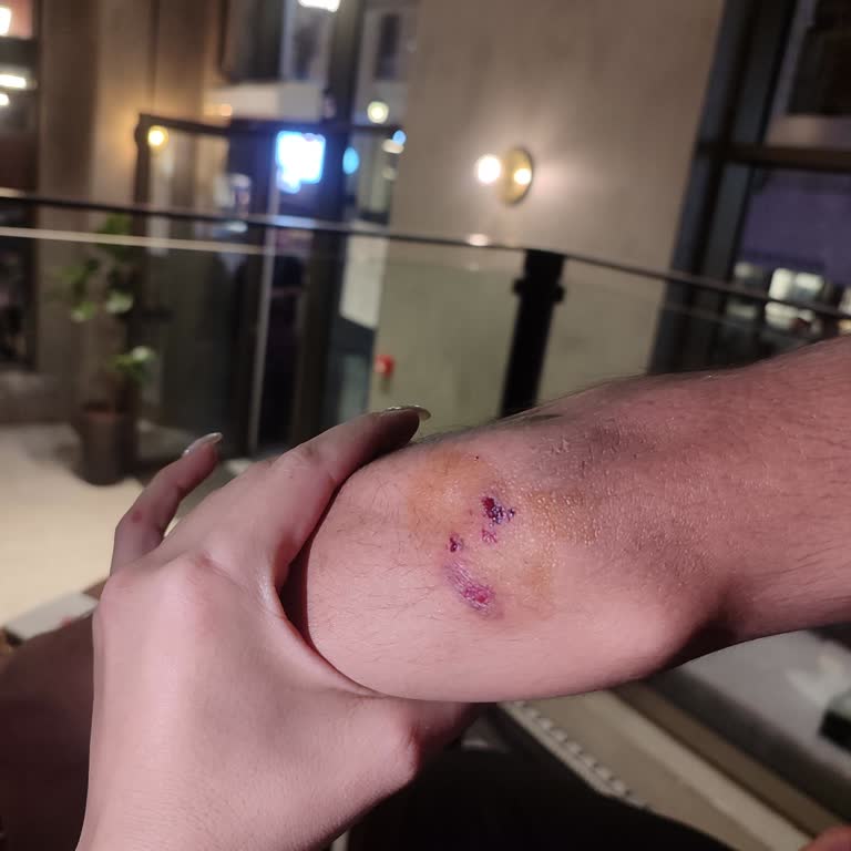 Kaza Sonrası İlgisizlik Ve Mağduriyet: Martı Tag’dan Acil Çözüm Bekliyorum