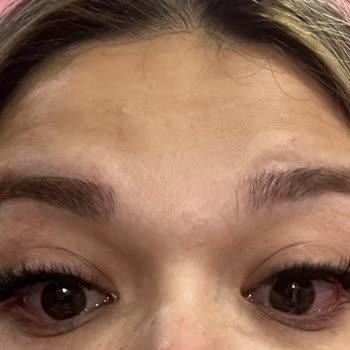 Güzellik Salonu İşleminden Sonra Yaşanan Sağlık Sorunları ve Mağduriyet