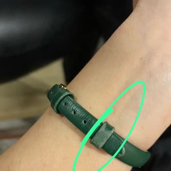 Tekrar Eden Kordon Soyulması Ve Çözülmeyen Garanti Sorunu