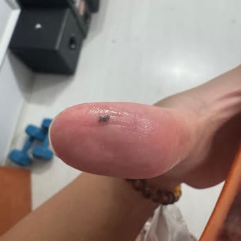 Siparişimde Çamur Benzeri Maddeyle Karşılaştım Hijyen Endişesi Yaşıyorum