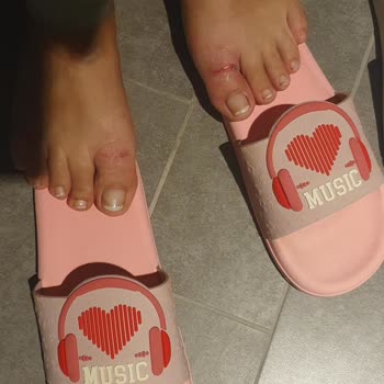 Gezer Terlik 15 Dakikada Yara Yaptı İade Talebim Var