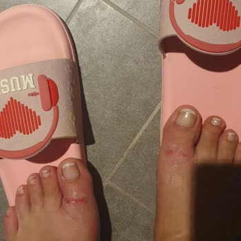 Gezer Terlik 15 Dakikada Yara Yaptı İade Talebim Var