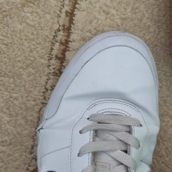 Ayakkabıda Kısa Sürede Deformasyon Ve Yetersiz Mağaza İncelemesi