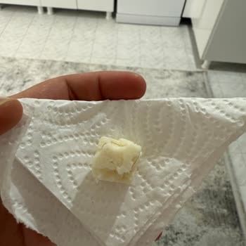 Beyaz Peynirden Kıl Çıktı, Hijyen Ve Ürün Değişimi Talebim Var