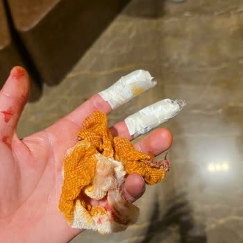 Otel Yönetiminin Haksız Çıkışı Ve İade Sorunu: Mağduriyetimizin Giderilmesini Talep Ediyoruz