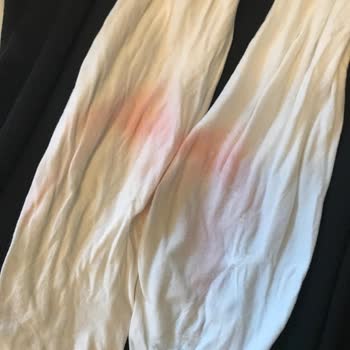 Yeni Alınan Spor Ayakkabıda Renk Atma Ve Açılma Sorunu