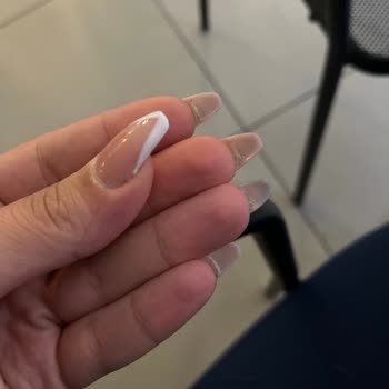 Protez Tırnak İşleminde İlgisizlik Ve Mağduriyet Yaşadık