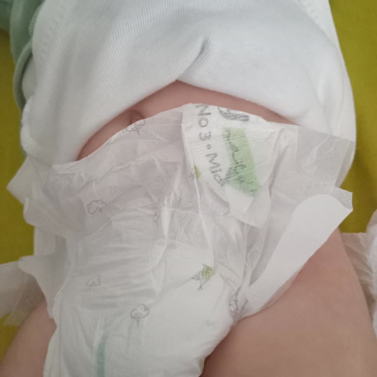 Sleepy Bebek Bezinde Üretim Hatası Ve Müşteri Hizmetlerine Ulaşamama Sorunu