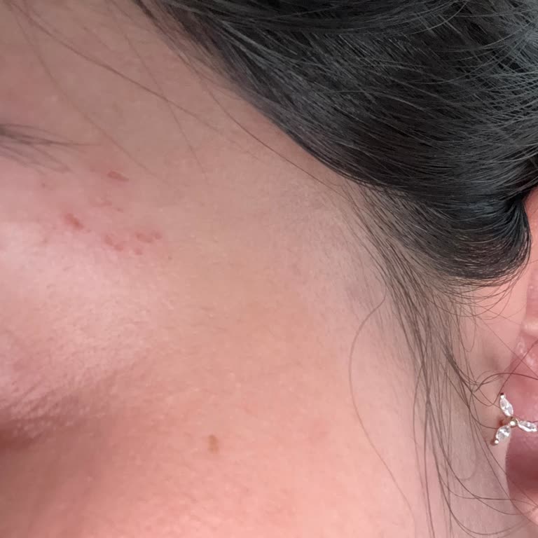 Kaş Alımı Sonrası Yaralanma Ve İlgisiz Hizmet