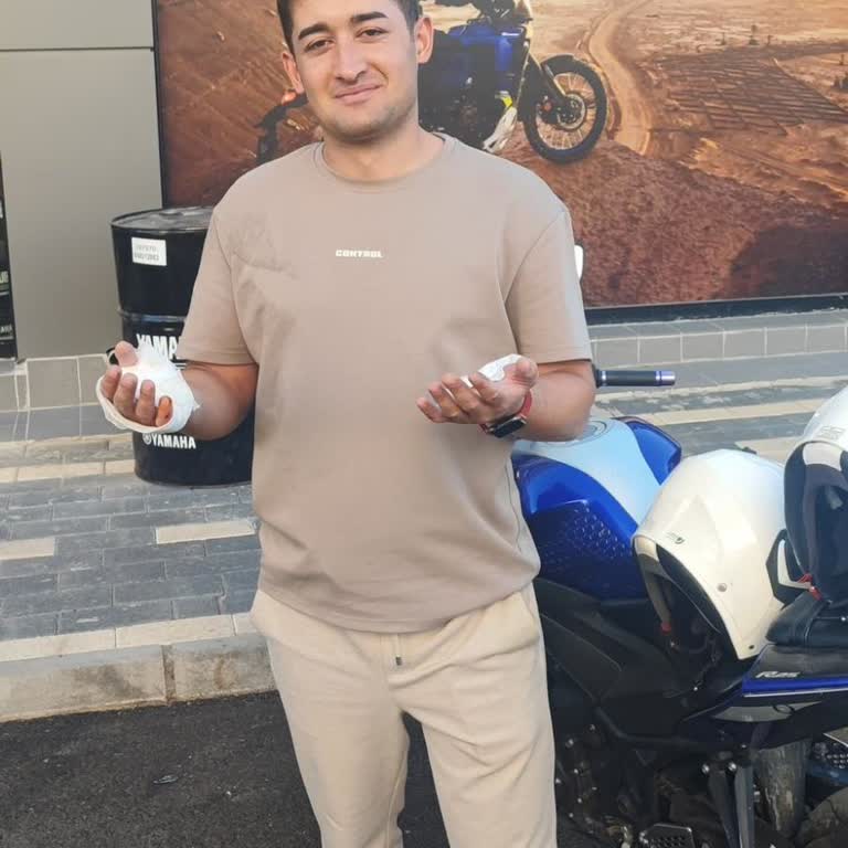 Tecno Mobile Telefonun Bataryası Bugün Elimde Patladı