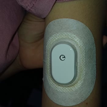 Glikoz Ölçüm Cihazı Arızası Ve Müşteri Hizmetlerine Ulaşılamaması