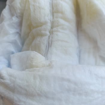 Molfix 5 Numara Bezlerde Kristal Jeller Bebeğimin Cildine Zarar Veriyor