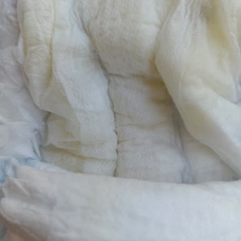 Molfix 5 Numara Bezlerde Kristal Jeller Bebeğimin Cildine Zarar Veriyor