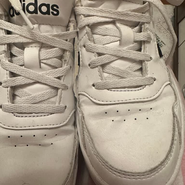 Aldığım Adidas Ayakkabı Kısa Sürede Deforme Oldu, Satıcıdan Geri Dönüş Alamadım