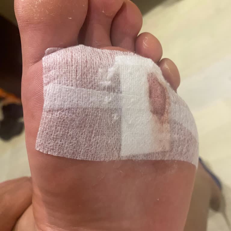 Havuzda Yaşanan Kaza Tatilimizi Mahvetti, Çözüm Sunulmadı!