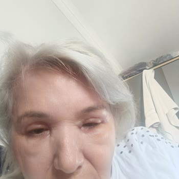 Saç Açıcı Sonrası Ciddi Sağlık Sorunları Ve Kalıcı Mağduriyet Yaşadım