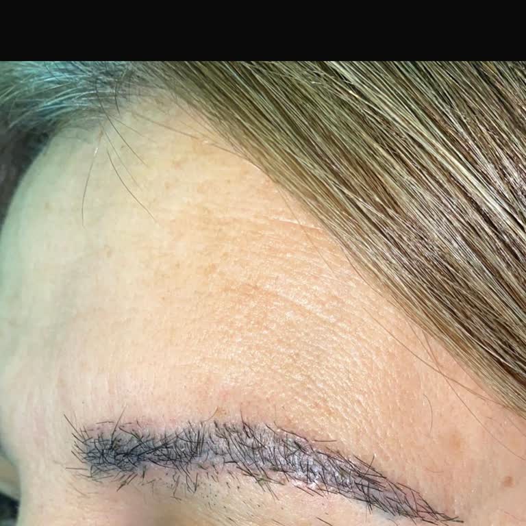 Emel Bayar Saç Ekim Merkezi Hizmetten Memnun Kalmadım