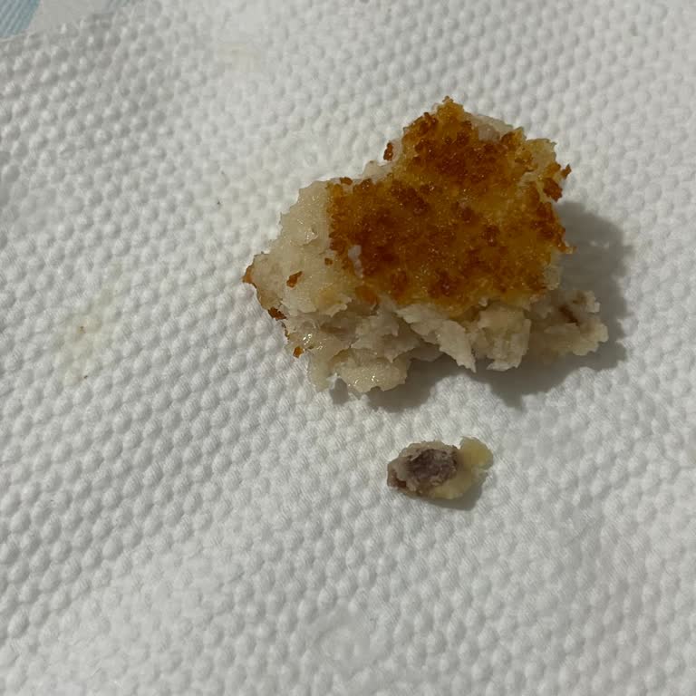 Aldığım Şinitzelin Tadında Sorun Ve İçinden Kemik Çıkması