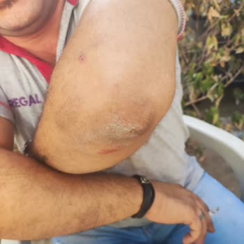 Teknik Servis Çalışanlarının Saldırısı Sonrası Maddi Ve Manevi Mağduriyet Yaşadım