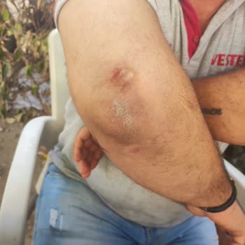 Teknik Servis Çalışanlarının Saldırısı Sonrası Maddi Ve Manevi Mağduriyet Yaşadım